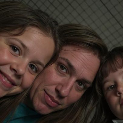 Virginia afirma que filhas passarão por cirurgia neste ano para tratamento