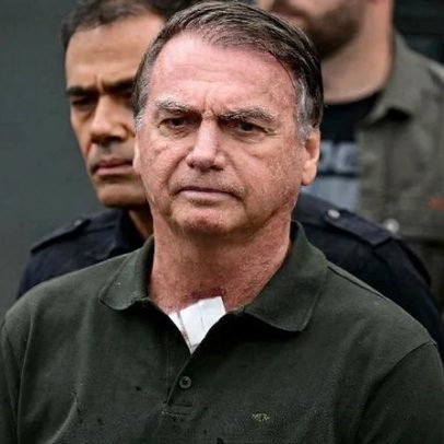 Bolsonaro pede ao STF tratamento com estimulação elétrica no crânio na prisão