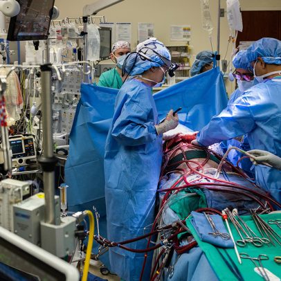 Homem sobrevive 48 horas sem pulmão; entenda como