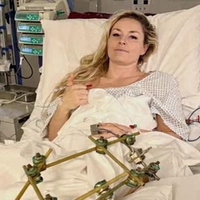 Lindsey Vonn diz que sucesso tem significado diferente após cirurgia na perna