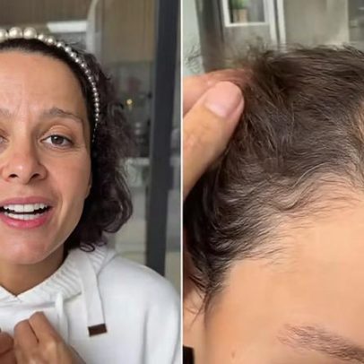 Maiara revela diagnóstico de alopecia androgenética e vitória no tratamento