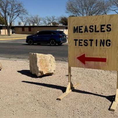 Casos de sarampo levam instalações do ICE no Texas à quarentena