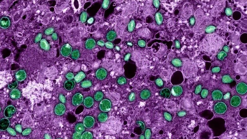Imagem do Micrografia eletrônica de transmissão colorizada de partículas do vírus mpox (verde) encontradas em células VERO E6 infectadas (magenta). As partículas virais estão em vários estágios de maturação, o que explica as diferenças de forma.