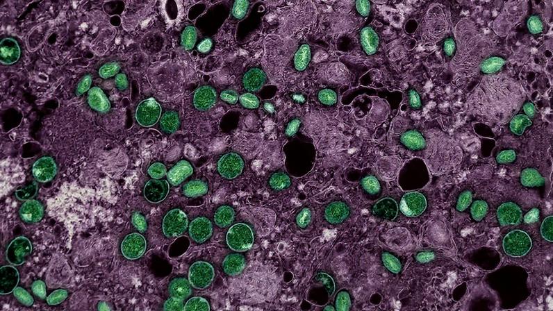 Imagem do Micrografia eletrônica de transmissão colorizada de partículas do vírus mpox (verde) encontradas em células VERO E6 infectadas (magenta). As partículas virais estão em vários estágios de maturação, o que explica as diferenças de forma.