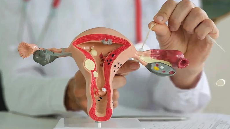 Médico ginecologista liga trompas de Falópio em exemplo de representação do sistema reprodutor feminino.