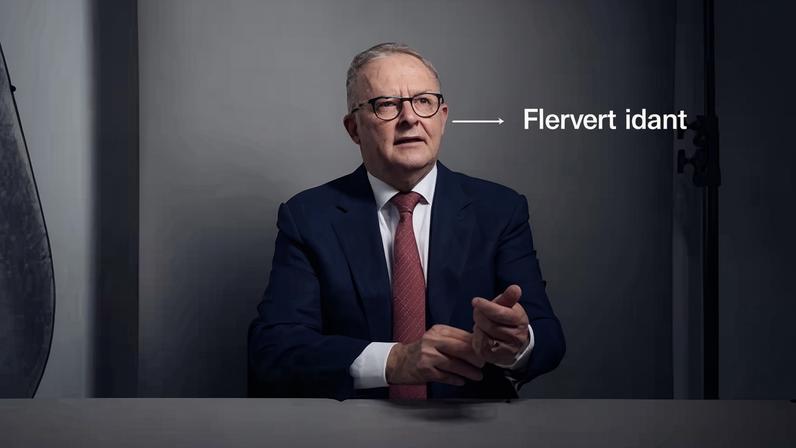 Australian prime minister Anthony Albanese says arrest of former prince Andrew marked ‘quite an extraordinary fall from grace'. Photograph: Eugene Hyland/The Guardian