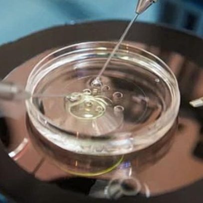 Pacientes de fertilidade vencem decisão para salvar embriões após consentimento