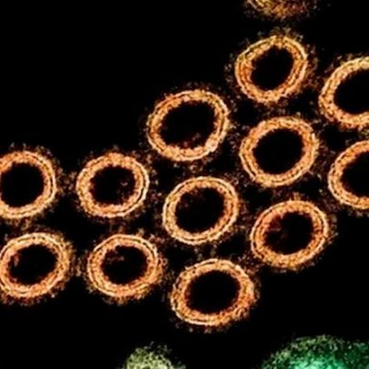 Catalunha alerta OMS sobre caso de gripe suína entre pessoas em Lleida