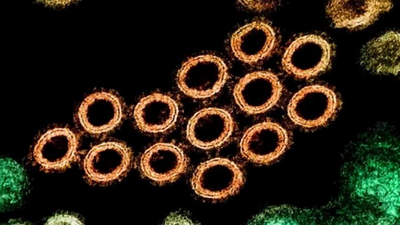 Una sección transversal de partículas de virus de gripe porcina.