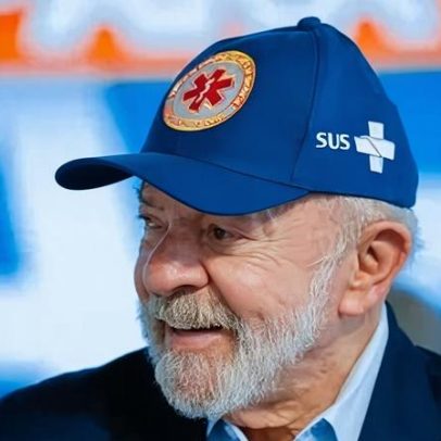Lula passa por cauterização para remover excesso de pele no couro cabeludo