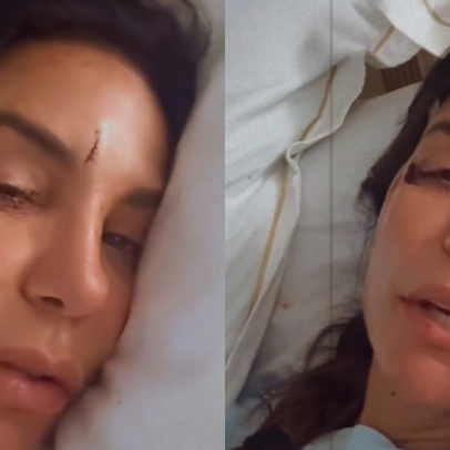 Ivete Sangalo tem ferimentos após desmaio e permanece internada em Salvador