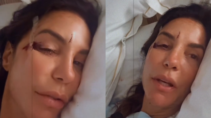 Ivete Sangalo mostra rosto com ferimentos após desmaiar em casa; cantora está internada em Salvador