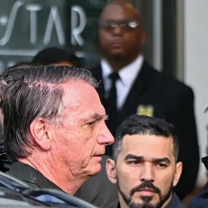 Moraes autoriza Bolsonaro a receber estímulo elétrico craniano