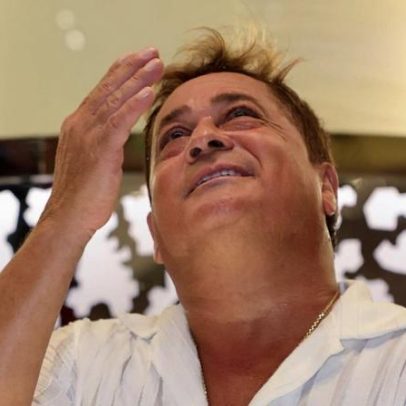 Leonardo revela resultado de blefaroplastia