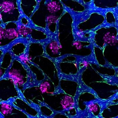 Novos modelos de tecido podem ajudar no desenvolvimento de fármacos para doenças hepáticas
