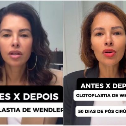 Ariadna Arantes revela mudança de voz 50 dias após cirurgia de feminização