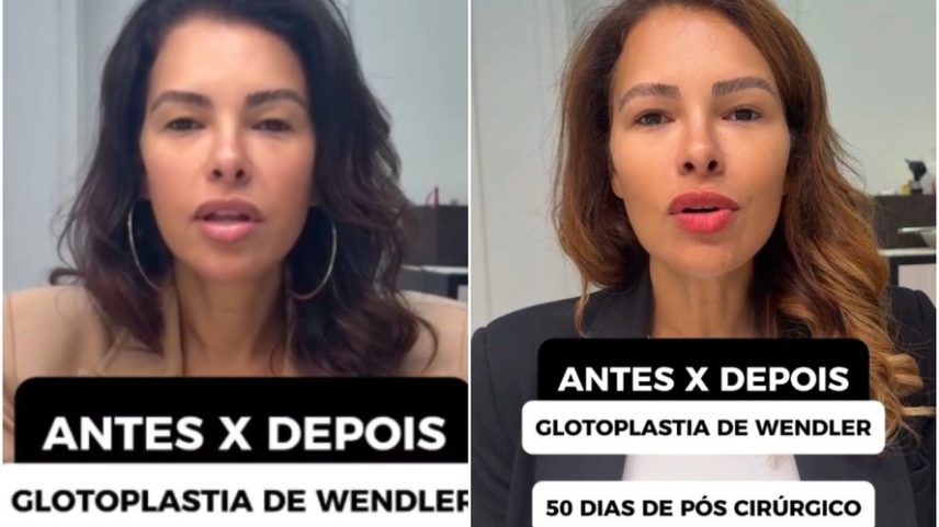 Ariadna Arantes mostrou o antes e depois da voz após cirurgia — Foto: Reprodução/Instagram