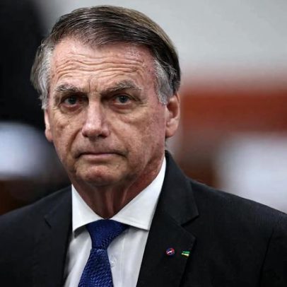 Bolsonaro busca autorização para estímulos elétricos no cérebro