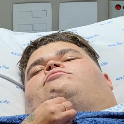 Gordão da XJ faz cirurgia de vesícula e se surpreende com pedras
