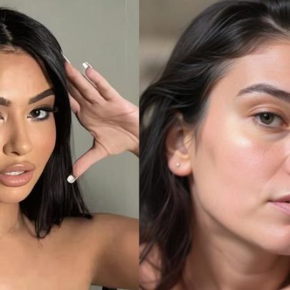 Influencer faz cirurgia estética e revela que achou que reduziria a idade