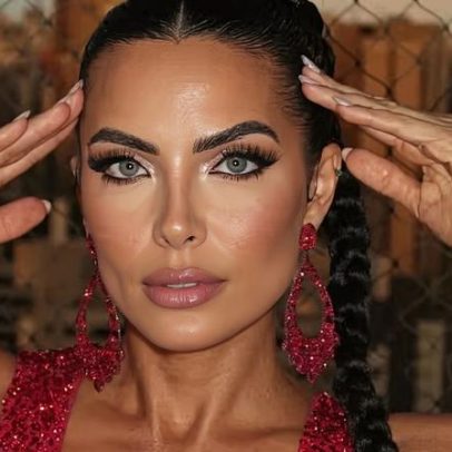 Carla Prata comenta diagnóstico de doença rara autoimune