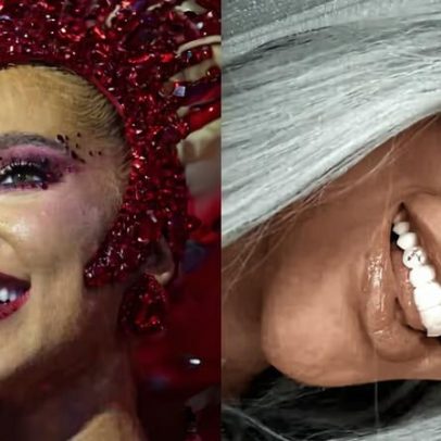 Dentista da Virgínia comenta diamante no dente da influenciadora para Vini Jr. no Carnaval