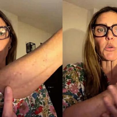 Fernanda Lima revela manchas na pele e reflexão sobre envelhecimento