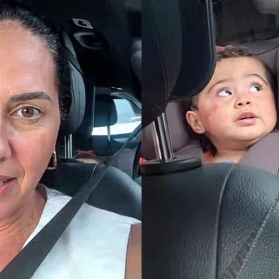 Graciele Lacerda explica mancha no rosto da filha e inicia desmame de corticoide