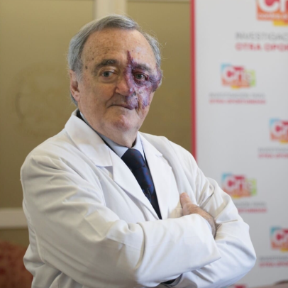 Banderas financia pesquisa de Mariano Barbacid em busca de avanço contra câncer de pâncreas