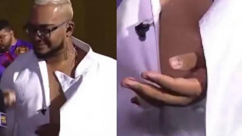 Igor Pitta, intérprete da Em Cima da Hora, sofre acidente antes de desfile