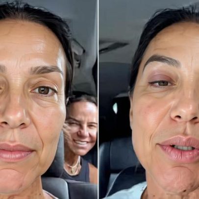 Síndrome vasovagal provoca desmaio e internação de Ivete Sangalo