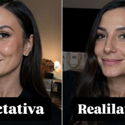 Ivete Sangalo mostra rosto após queda e brinca com expectativa e realidade