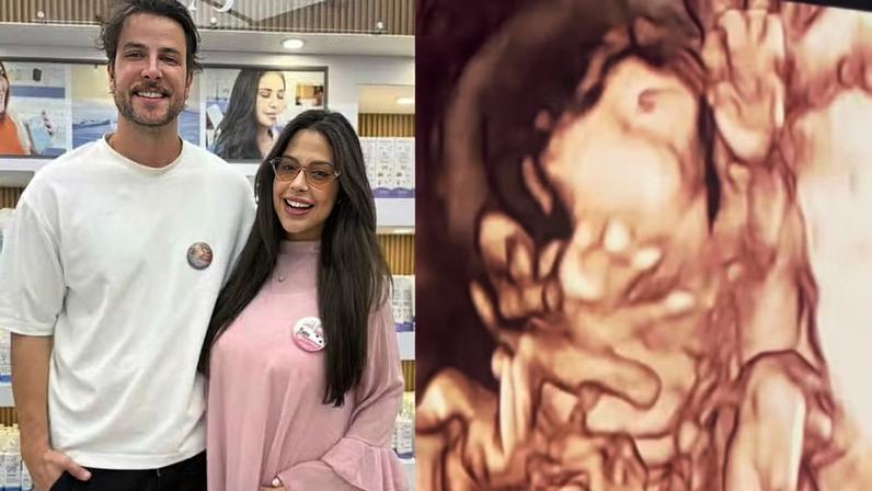 Lais Caldas e Gustavo Marsengo se empolgam com ultrassom 4D — Foto: Reprodução/Instagram