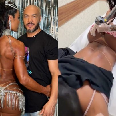 Gracyanne Barbosa inicia retirada de tatuagem dedicada ao ex ao som de Belo