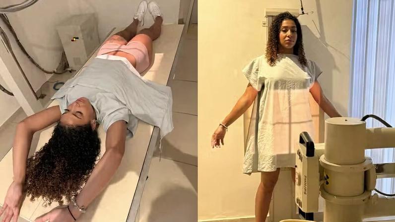 Influenciadora exibe raio-x após bolas de pompoarismo ficarem presas durante prática