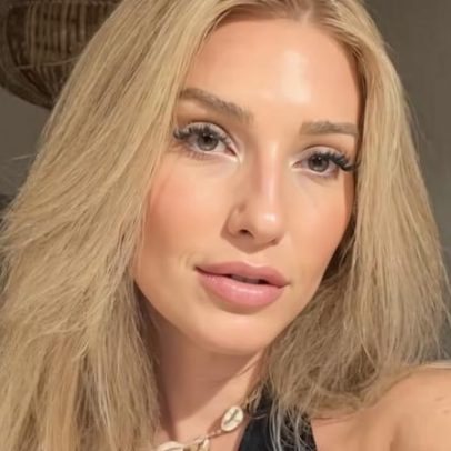 Amanda Meirelles detalha tratamento de lipedema e lipo na perna