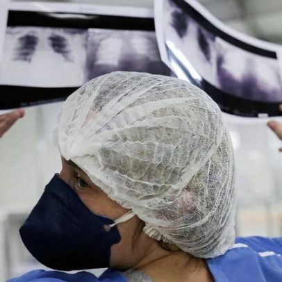 Brasil deve registrar 781 mil novos casos de câncer por ano até 2028
