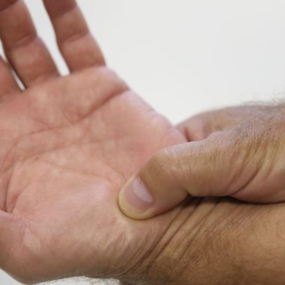 Novas diretrizes ampliam tratamento da fibromialgia pelo SUS