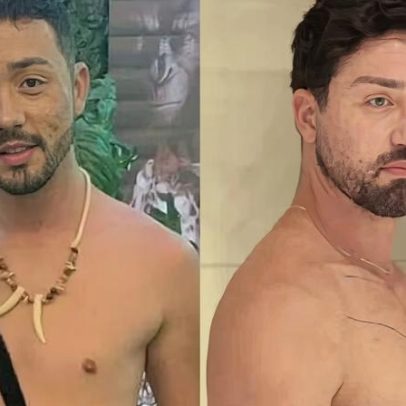 Rico Melquiades faz nova remodelação corporal e diz não querer parar com cirurgias