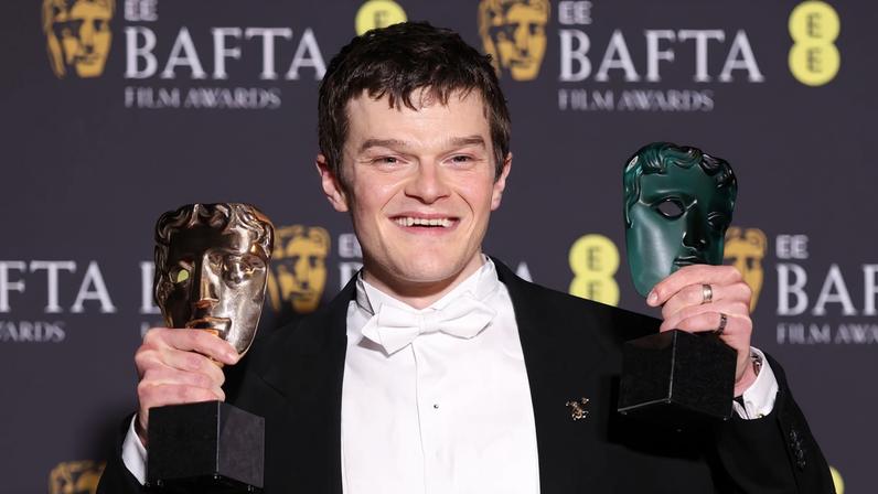 Robert Aramayo surprisingly won Best Actor at the BAFTAs for his performance in “I Swear.”