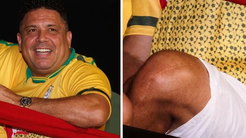 Ronaldo Fenômeno exibe cicatriz icônica no joelho durante folia na Sapucaí; FOTOS — Foto: Brazil News