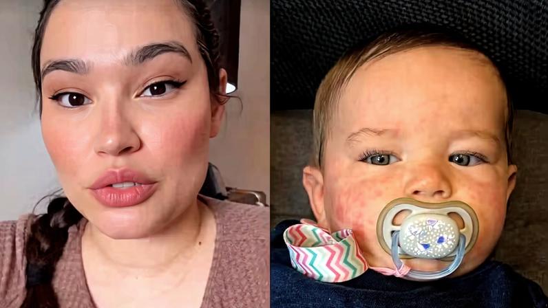 Raissa Barbosa se manifesta após susto com manchas no filho de 8 meses: 'É uma doença viral'
