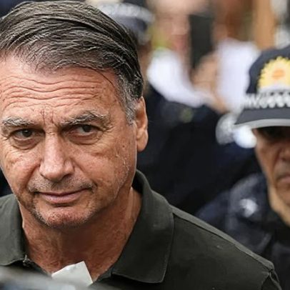 PF aponta alterações neurológicas em exame de Bolsonaro