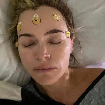 Teddi Mellencamp celebra 1º aniversário de cirurgia cerebral com reflexão
