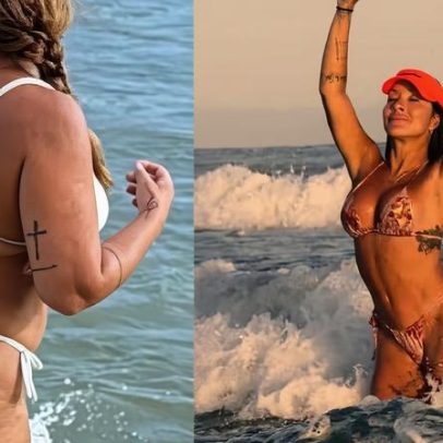Vivi Fernandez mostra antes e depois de procedimentos estéticos