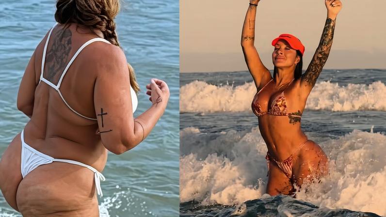 Vivi Fernandez antes e depois de cirurgias plásticas — Foto: Divulgação
