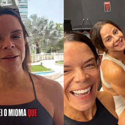 Carol Vaz detalha retirada de mioma e volta ao trabalho com Viviane Araujo