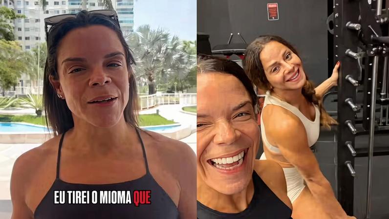 Carol Vaz detalha retirada de mioma e volta ao trabalho com Viviane Araujo