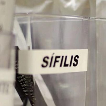 SUS adota antibiótico para prevenção de sífilis e clamídia
