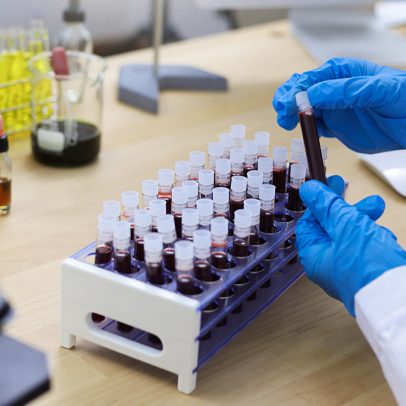 Pesquisa identifica ISTs em 20% das gestantes em Salvador